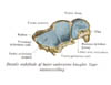 radiusulna4
